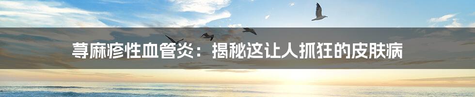 荨麻疹性血管炎:揭秘这让人抓狂的皮肤病