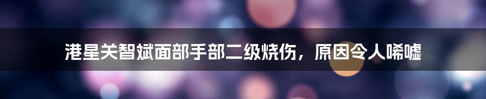 港星关智斌面部手部二级烧伤,原因令人唏嘘