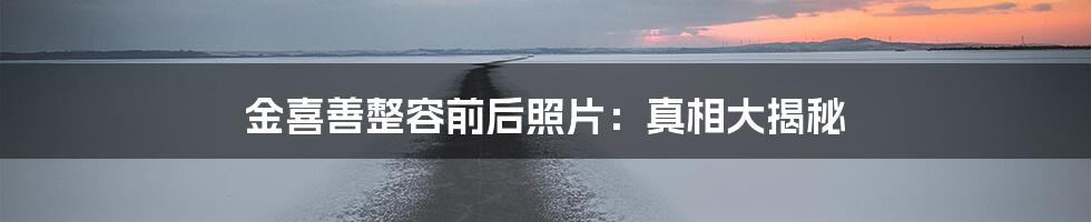 金喜善整容前后照片:真相大揭秘