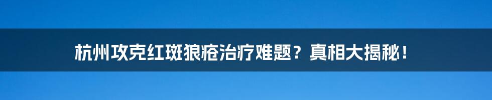 杭州攻克红斑狼疮治疗难题?真相大揭秘!
