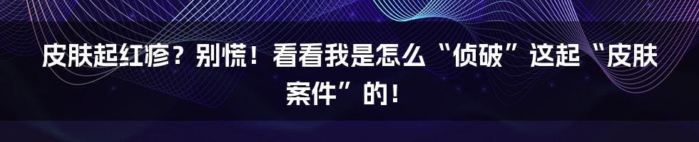 皮肤起红疹?别慌!看看我是怎么“侦破”这起“皮肤案件”的!