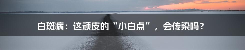 白斑病:这顽皮的“小白点”,会传染吗?